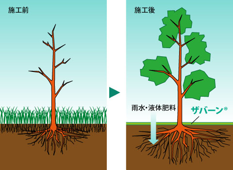 ザバーン®とは